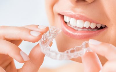 INVISALIGN