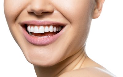 SBIANCAMENTO DENTALE